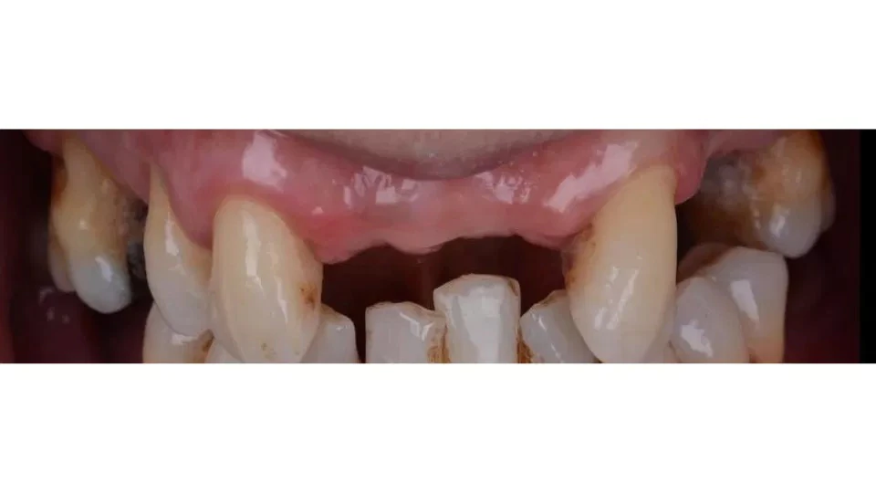 Before image
