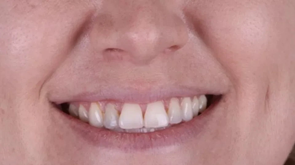 Before image