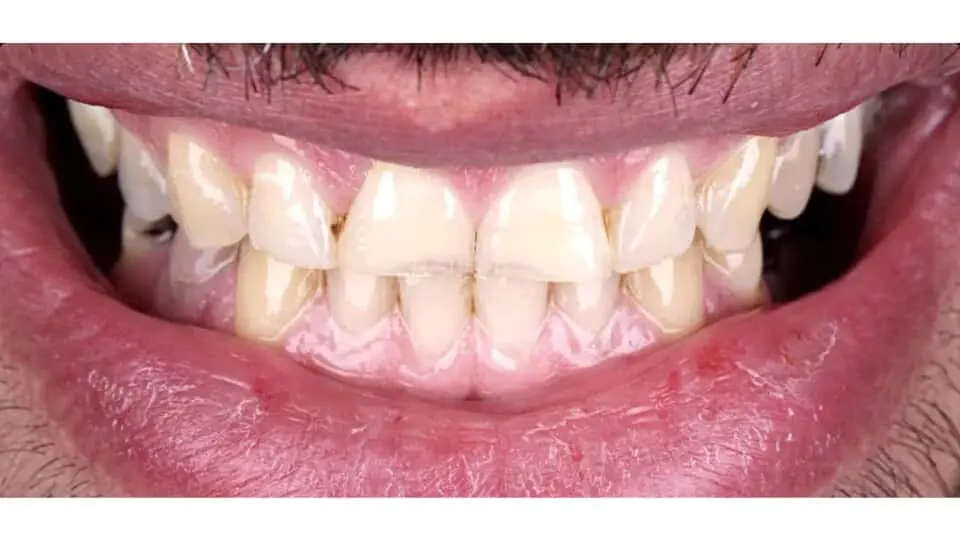 Before image