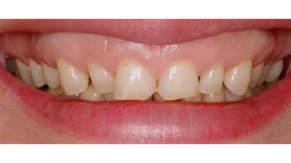 Before image
