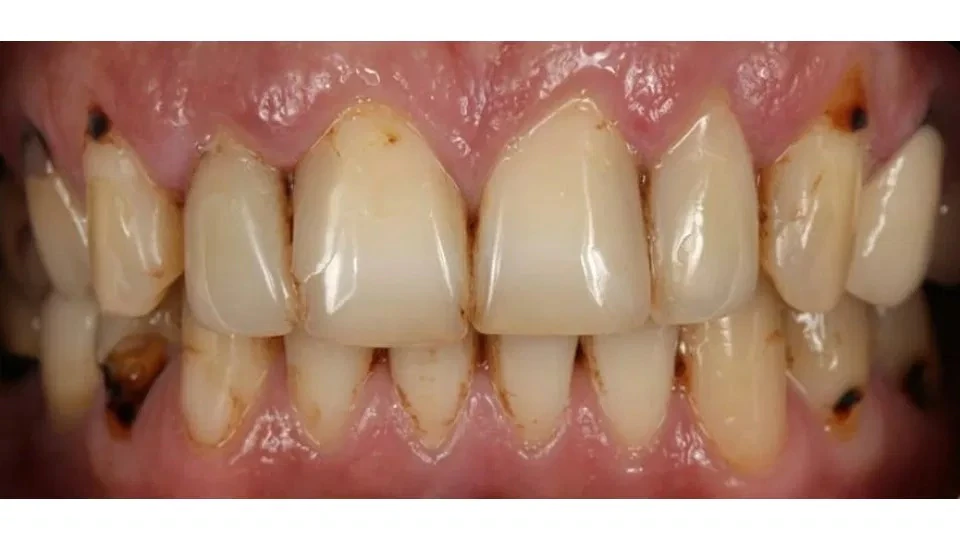 Before image