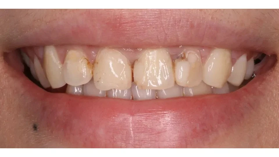 Before image