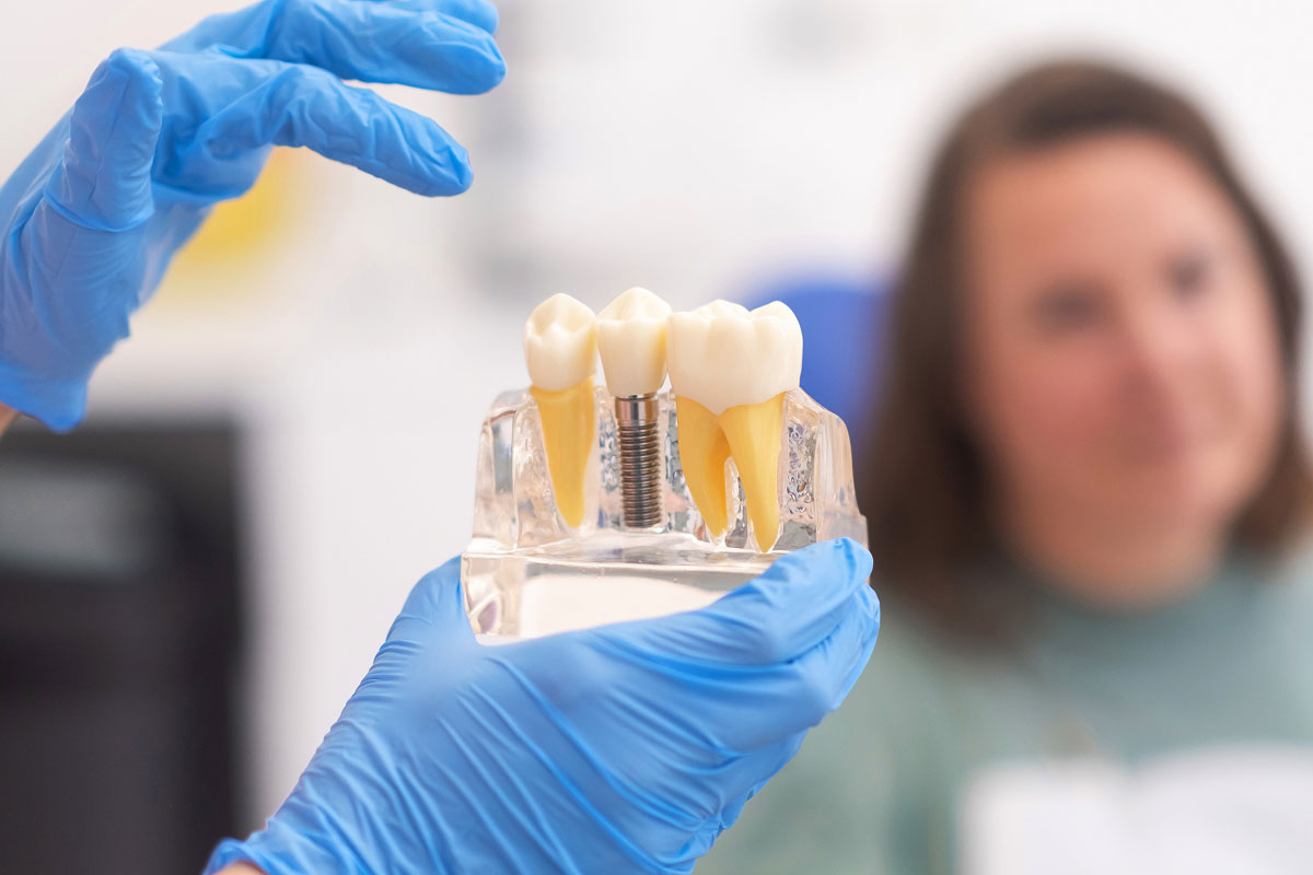 dental implants offered at North Georgia Smiles