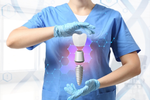 5 FAQs About Dental Implants from North Georgia Smiles in Cumming, GA